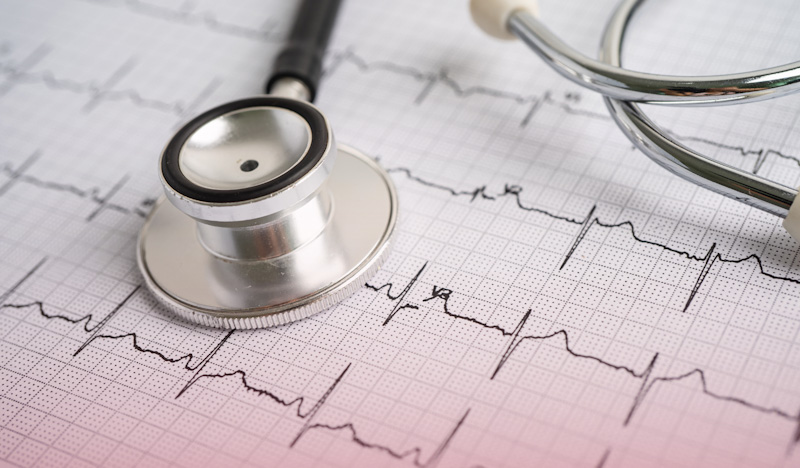 EEG printout and stethoscope