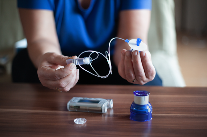 Insulin Pump Before Application R